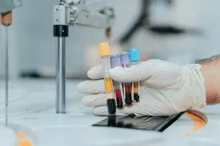 AI-designed drug hints at reversing biological clocks in early trial