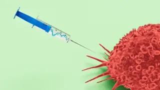 KRAS Vaccine Shows Promise in Intercepting Pancreatic Cancer