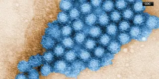 Bentwood Elementary Norovirus Outbreak Reaches 97 Cases in Johnson County