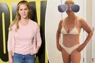 Amy Schumer Declares Warrior Spirit After C-Section Scar Reveal
