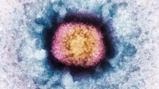 Brain Gene BC200 Found Jumping into Human Poxvirus, Blurring Gene Boundaries