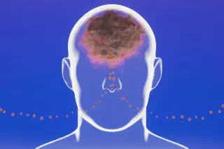 Airborne debris and neighborhood greenery emerge as key factors in brain health