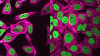 NYU Study Finds Human Genome Resilient to Short-Term Simulated Microgravity