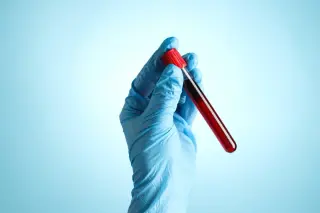 Kerala's Red Rain: Spores or Space Panspermia?
