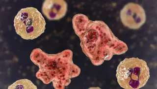 NC Teen Faces Rare Brain Amoeba Infection from Warm Freshwater