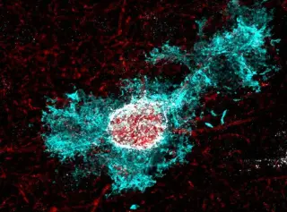 Cortisol Acts as Brain-Development Clock to End Early Plasticity