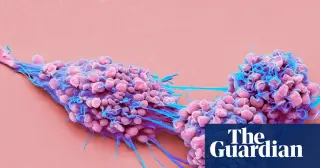 England approves first breakthrough ovarian cancer drug in over two decades