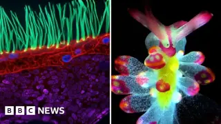 Cilia under the lens: 100x win for Nikon's Small World In Motion