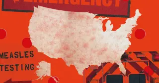US Measles Surge Forces Hospitals to Revive Outdated Protocols