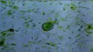 Cyclospora: the hidden parasite behind explosive diarrhea from raw produce