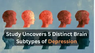 MEG Scans Reveal Five Distinct Brain Profiles for Depression, Challenging Uniform Diagnosis