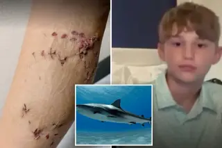 Brother’s swift rescue saves 12-year-old after Bahamas shark attack