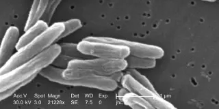 Tucson school district notifies parents of active tuberculosis case at Van Buskirk Elementary