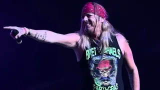 Bret Michaels Pauses Touring to Heal After Surgeries and Diabetes Risks