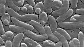 Florida reports another Vibrio death as cases rise in 2026