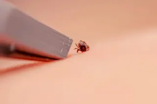 Tick bite playbook: safe removal and when to seek care