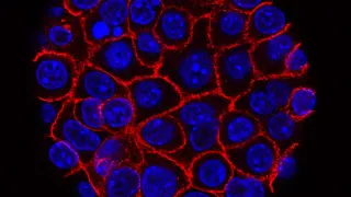 Pancreatic cancer drug duo shows durable responses, advancing to Phase 3