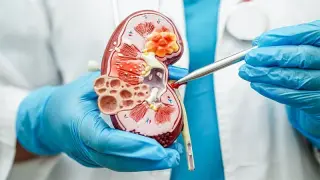 Aggressive Blood Pressure Drops Cut Heart Risk but Accelerate Kidney Function Decline