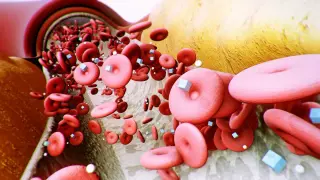 ETH Zurich Implant Uses Electricity to Convert Blood Sugar Into Harmless Byproduct