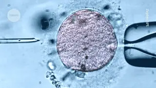 Clinics Push MRT for IVF Despite Limited Evidence
