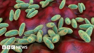 Siberian Lab Worker Death Sparks Global Plague Concerns Amid Russian Denials
