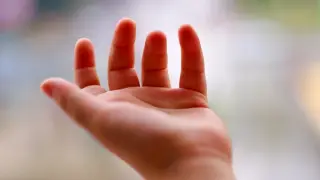 Cerebral Palsy Reframed as a Symptom Cluster, Not a Single Disease