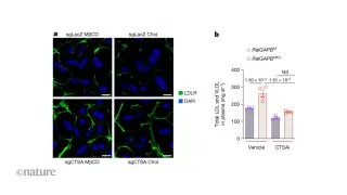 Dietary cholesterol slows liver clearance via a Ral-driven LDLR turnover pathway