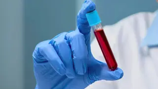 Blood Tests Reveal New Markers Linking Mediterranean Diet to Longevity and Cellular Health