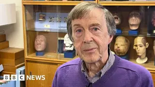 74-year-old gains hearing on left side via new prosthetic ear in Northern Ireland