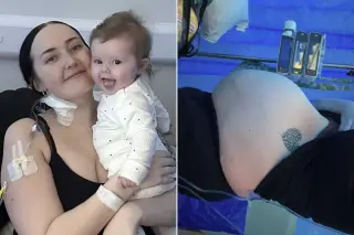 Postpartum lump labeled 'squishy' belly leads to rare terminal cancer diagnosis
