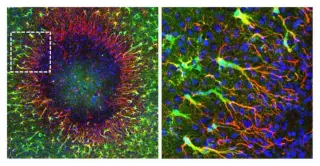 Astrocyte Nuclei Travel to Rebuild Damaged Brain Networks