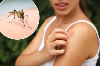Scratch that itch at your own risk, science explains why