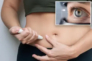 GLP-1 Lawsuits Surge Over Rare 'Eye Stroke' Claims