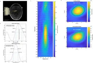 Pilot Trial Finds 10-Minute Ultrasound Sessions Reduce Delusions in Schizophrenia