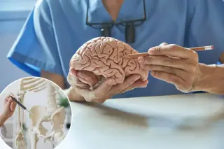Spine Bone Density May Predict Rate of Cognitive Decline