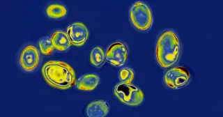 Washington reports 13 cases of hard-to-treat Candida auris in healthcare settings