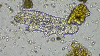 North Carolina Teen Dies After Rare Brain-Eating Amoeba Exposure in Freshwater
