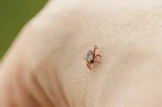 Tick-borne brain inflammation threat expands across the U.S.