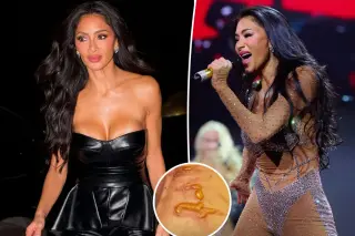Nicole Scherzinger Performs in Düsseldorf Despite Severe Boil-Water Burn