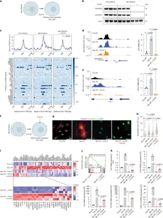 Mitochondrial citrate metabolism governs aging-related inflammation via epigenetic SASP control