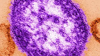 Bangor measles signal from wastewater prompts vaccination push