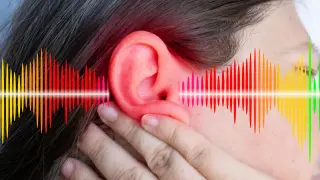 Serotonin May Amplify Tinnitus Through a Specific Brain Circuit