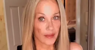 Christina Applegate Returns to Social Media with New Hair After Months-Long Hospitalization