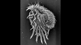 Tiny ciliate’s momentary 'supergiant' cannibal phase rewrites single-celled limits