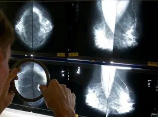 Health Officials Probe Possible Breast Cancer Cluster at Uxbridge High