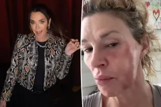 Brandi Glanville Credits RHOBH Sisterhood for GoFundMe Support Amid Financial Crisis
