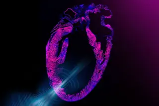 MIT's Wearable Ultrasound Patch Paces the Heart Without Surgery
