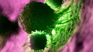 Personalized mRNA Vaccine Sparks Long-Term Survival in Pancreatic Cancer