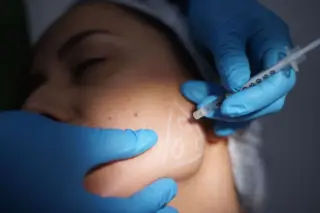 Botox for TMJ Pain: Young Women Seek Jaw-Relaxing Injections Amid NHS Delays