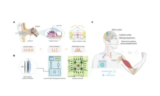 China unveils bionic auditory neural interface capable of understanding sound